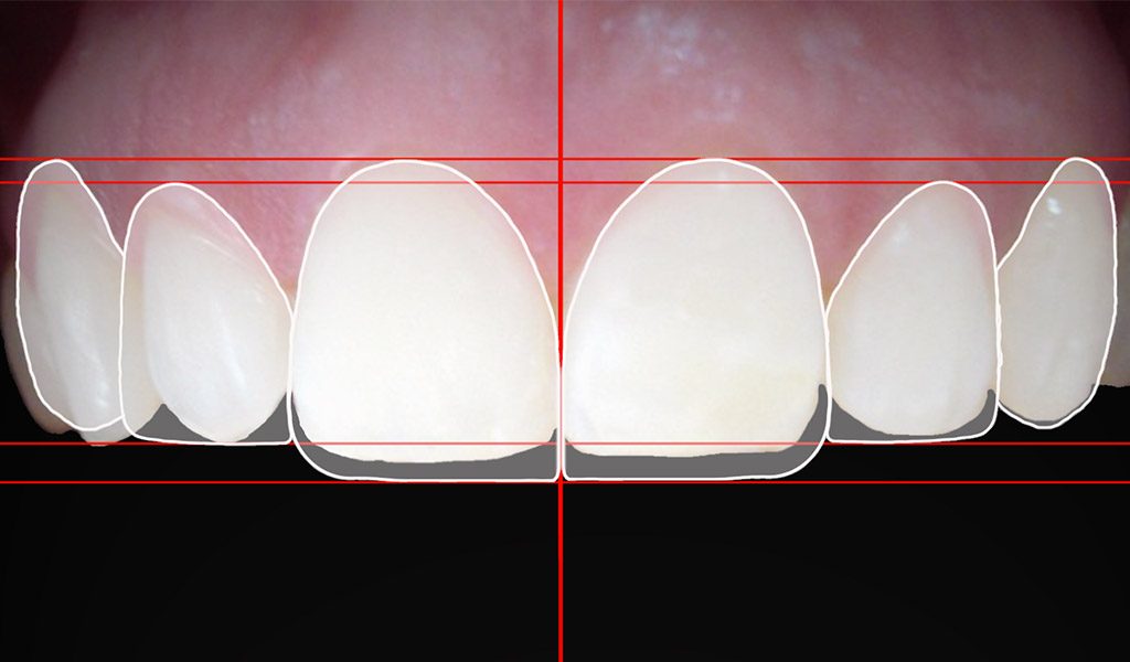 Estètica dental a Manresa